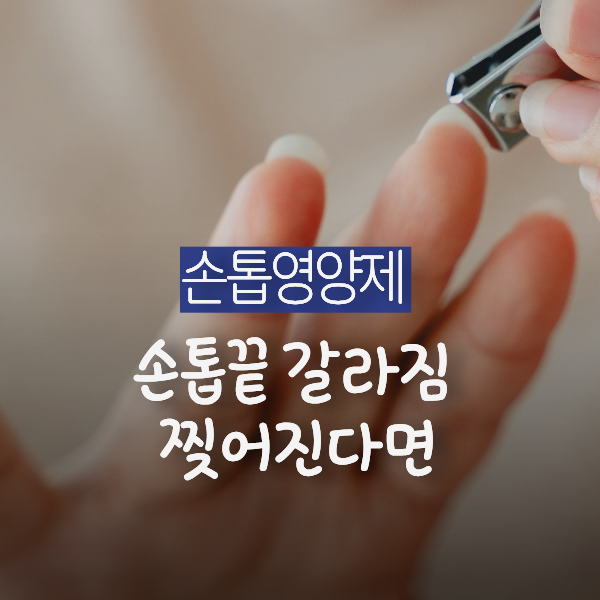 손톱끝 갈라짐 찢어짐 증상있다면 어떤 영양제 먹어야하나요?