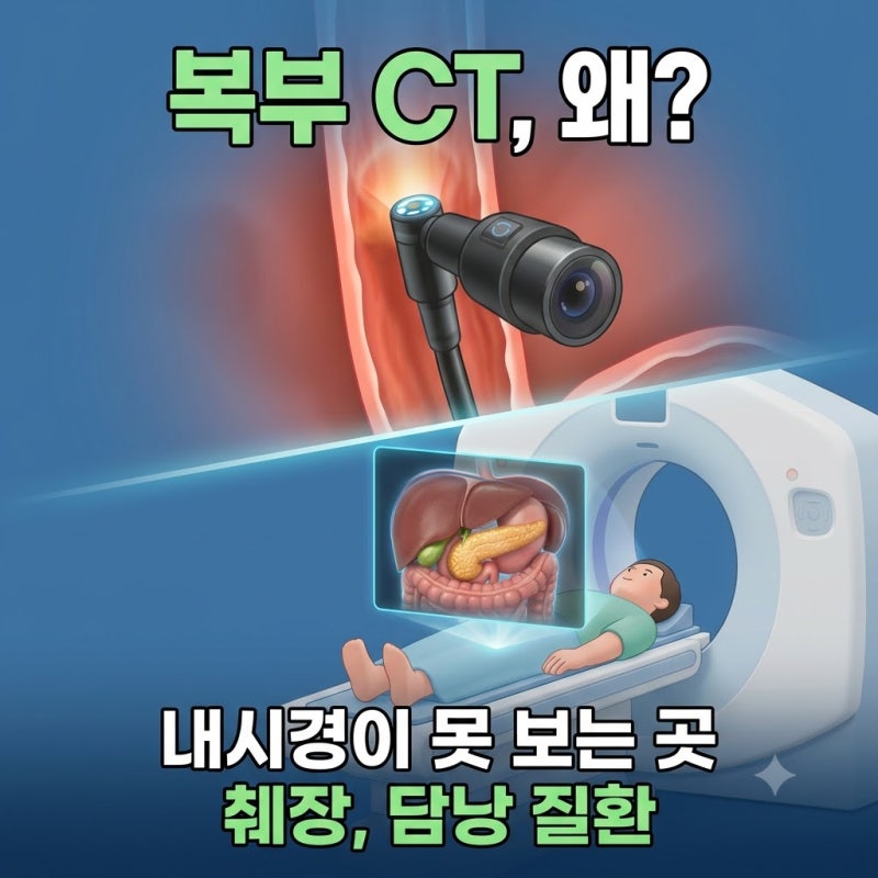복부 CT 위대장내시경으로 못 찾는 췌장 담낭 질환 확인하는 이유