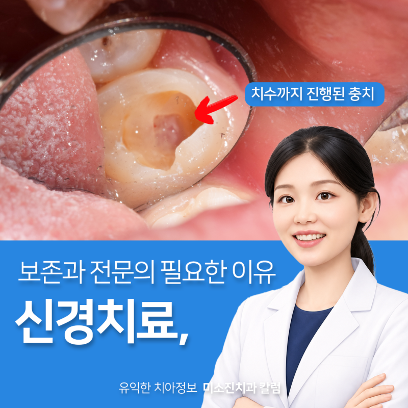 부산 신경치료 잘하는 곳 전문의가 있는지 확인하는 이유