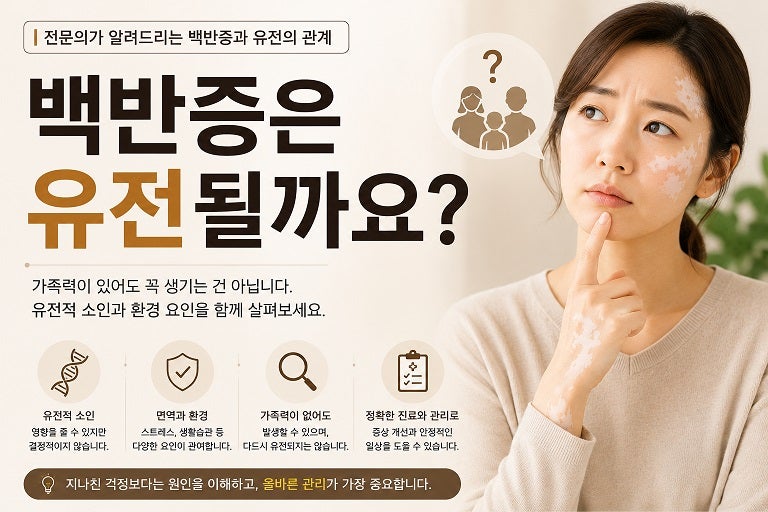 백반증은 유전이 되나요? 부모가 백반증이면 아이도 생길까요?