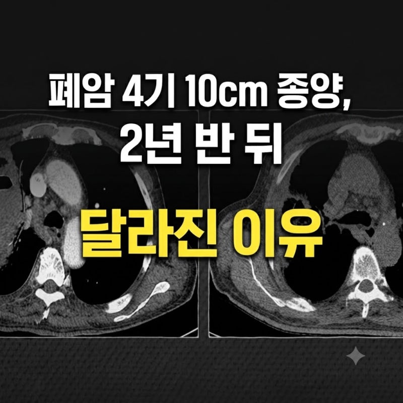 폐암 4기 10cm 종양, 2년 반 뒤 달라진 이유