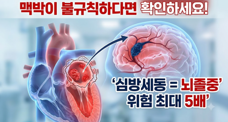 맥박이 불규칙하다면 확인하세요 — 심방세동이 뇌졸중 위험을 5배 높이는 이유