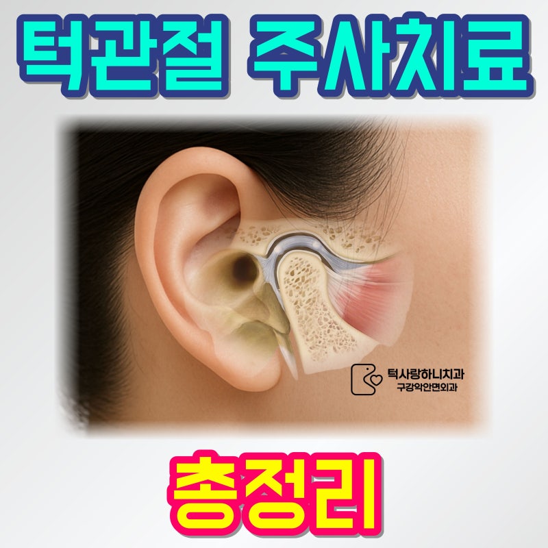 턱관절 세정술·PDRN주사·프롤로주사 차이점 총정리