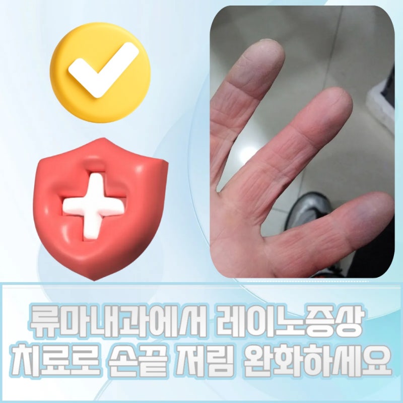 대전 대덕구 손가락 색이 변하는 레이노증후군 류마티스 관련이 있을까
