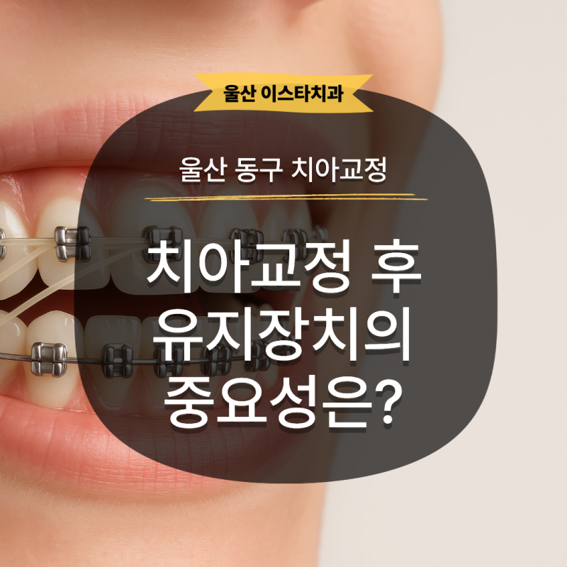 치아교정 후 유지장치가 중요한 이유와 올바른 착용·관리법
