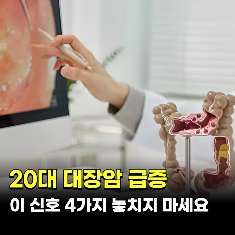 20대 대장암 환자 급증.. '이 신호' 4가지 절대 놓치지 마세요