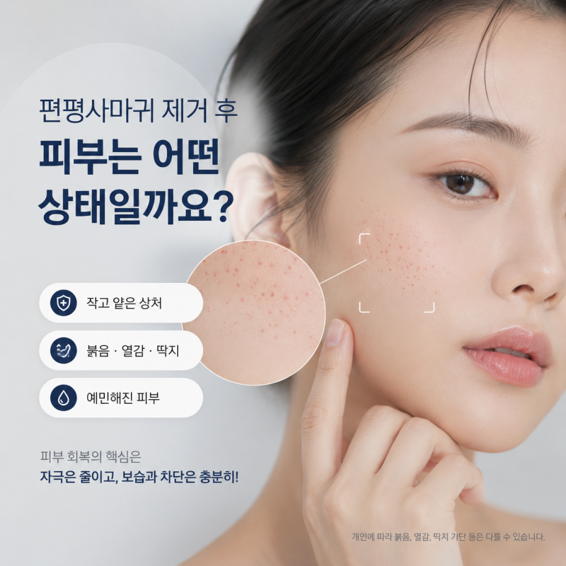 평택 편평사마귀 제거, 잘 제거하는 것보다 ‘그다음’이 중요합니다붉은 자국과 색소침착....
