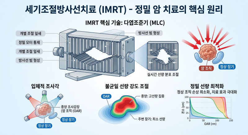 세기조절방사선치료(Intensity-Modulated Radiation Therapy, IMRT)는? 양성자치료 (Proton Therapy) 는?