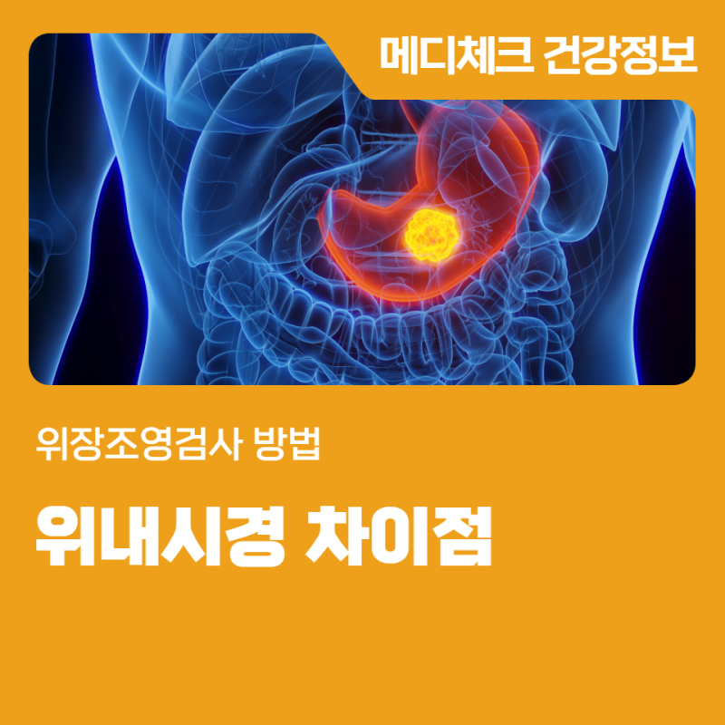 위장조영검사 방법 마산 위내시경 차이점은?