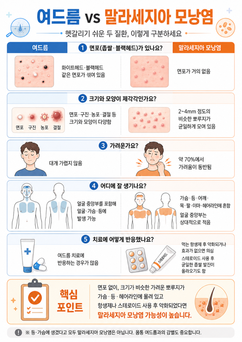 말라세지아 모낭염 vs 여드름, 어떻게 구분하나요? (말라세지아 모낭염 감별법)