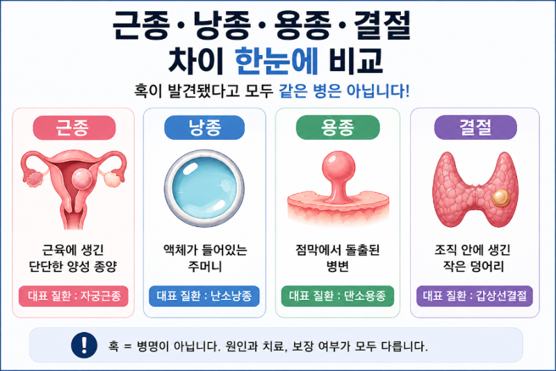 혹이 발견됐다고 모두 같은 병은 아닙니다.근종·낭종·용종·결절 차이 쉽게 이해하기