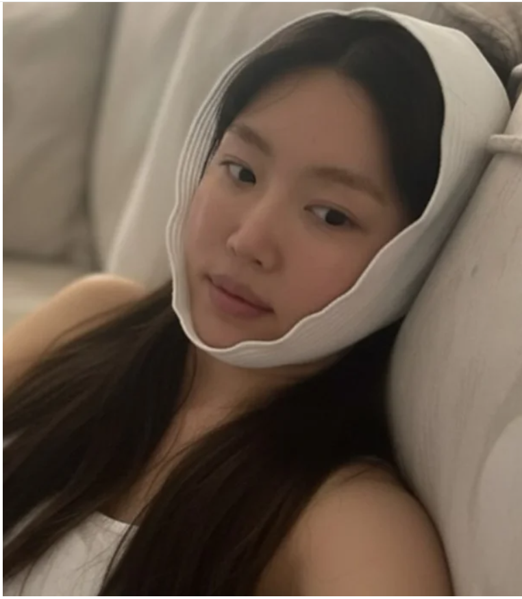 강예원 눈 성형 7번 고백, 앞트임 복원 후 달라진 근황…예전 얼굴 돌아왔다는 반응