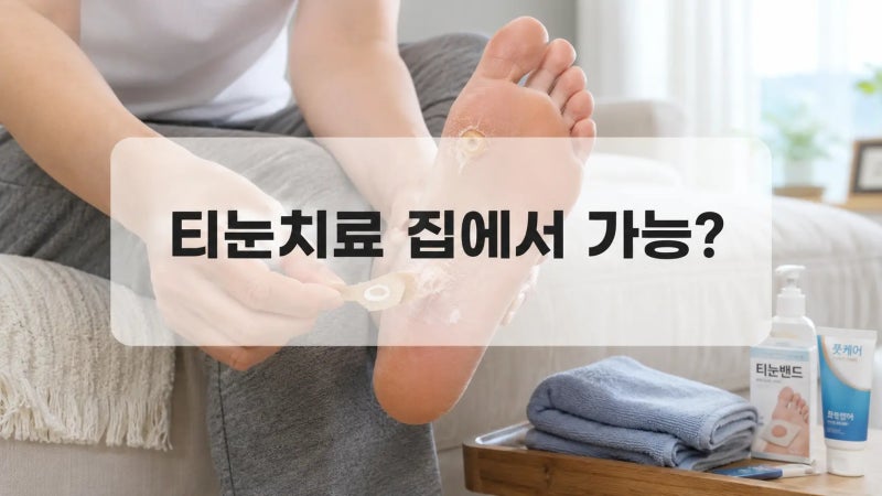 발바닥 티눈치료 집에서 가능할까? 티눈밴드 사용법과 재발 막는 법