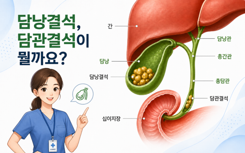 복부초음파에서 담낭결석 또는 담관결석이 발견되면 치료해야 할까요? 건강검진 결과 쉽게 ....