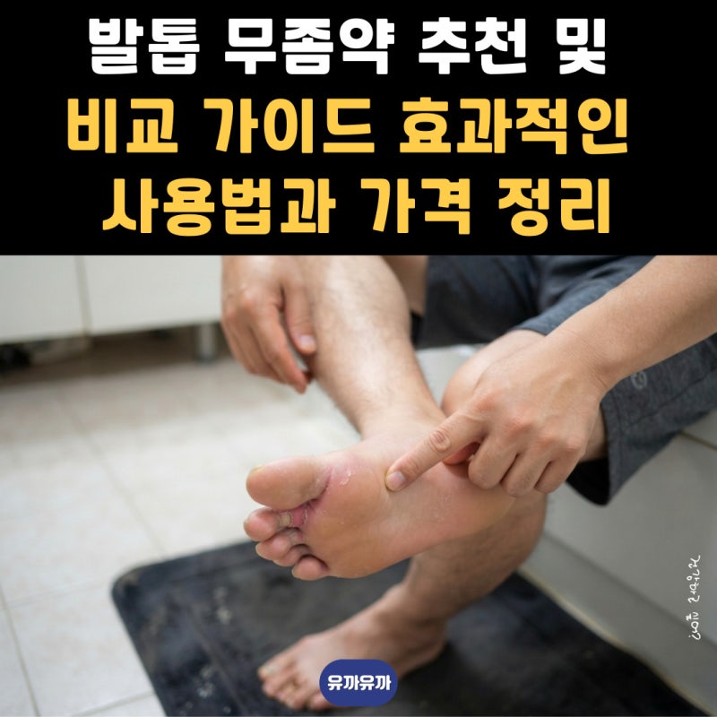 발톱 무좀약 추천 및 비교 가이드 효과적인 사용법과 가격 정리
