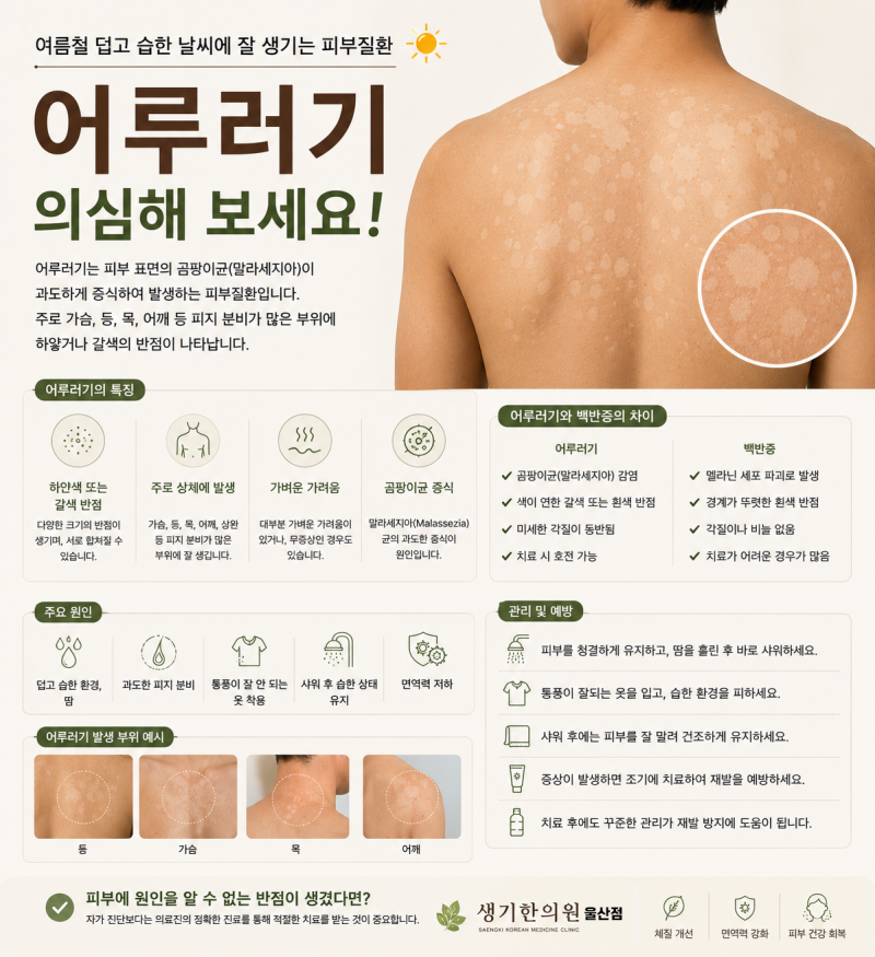 울산 등과 가슴에 생긴 얼룩, 어루러기일 수 있습니다
