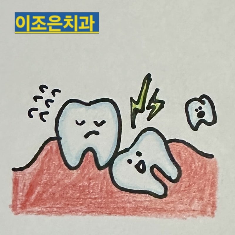 청천동 사랑니 사랑니를 뽑은 후에 지혈제를 써야 될까요?