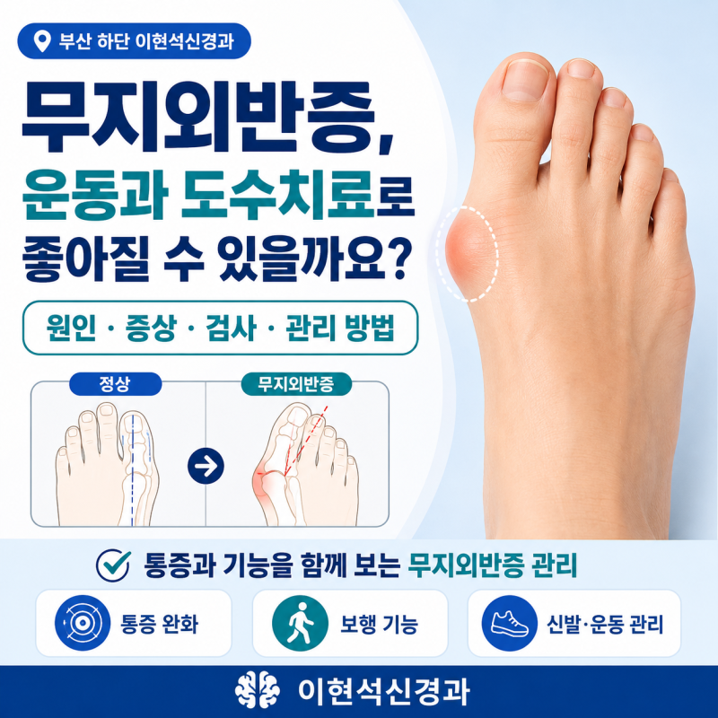 부산 괴정 무지외반증, 도수치료와 운동으로 좋아질 수 있을까요?