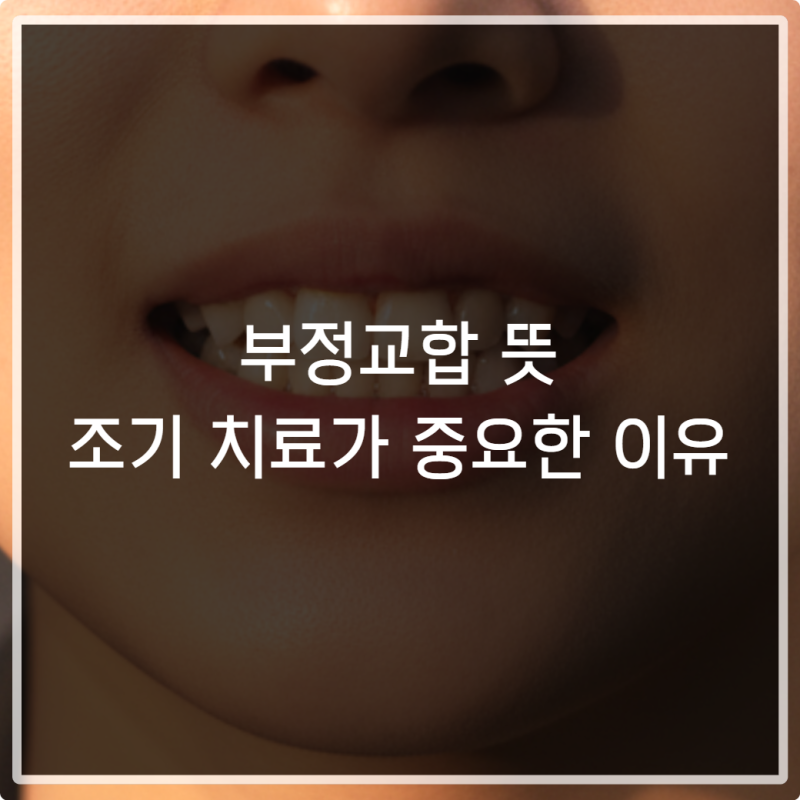부정교합 뜻과 조기 치료가 중요한 이유 알아보기