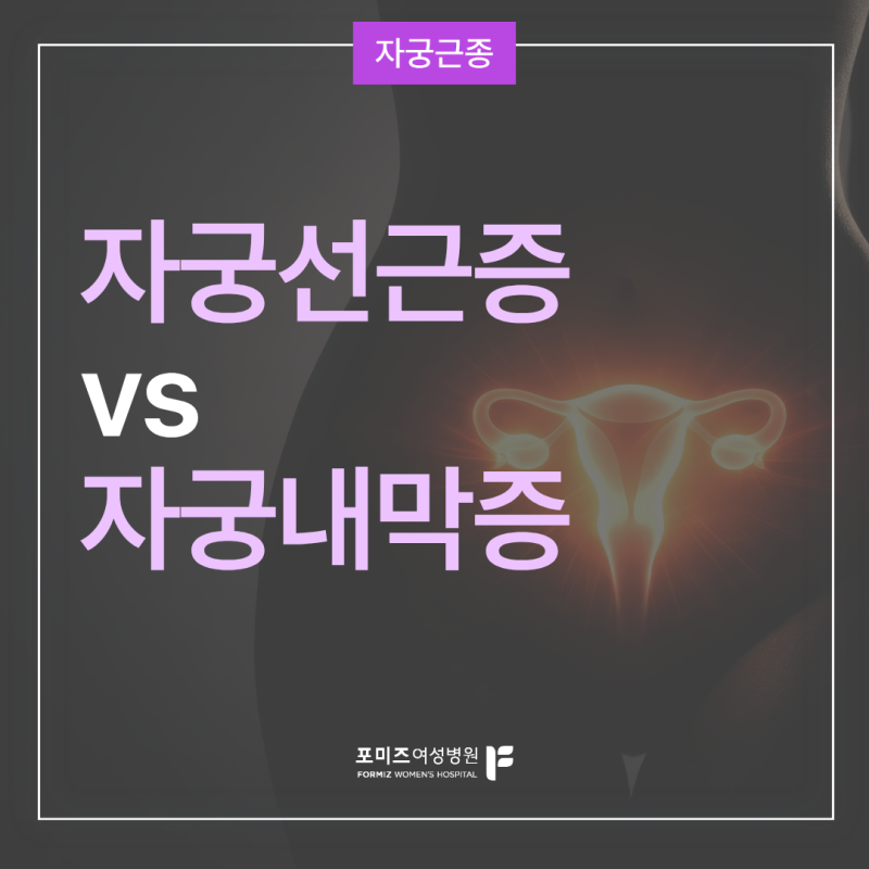 자궁선근증과 자궁내막증, 이름은 비슷하지만 전혀 다른 질환입니다