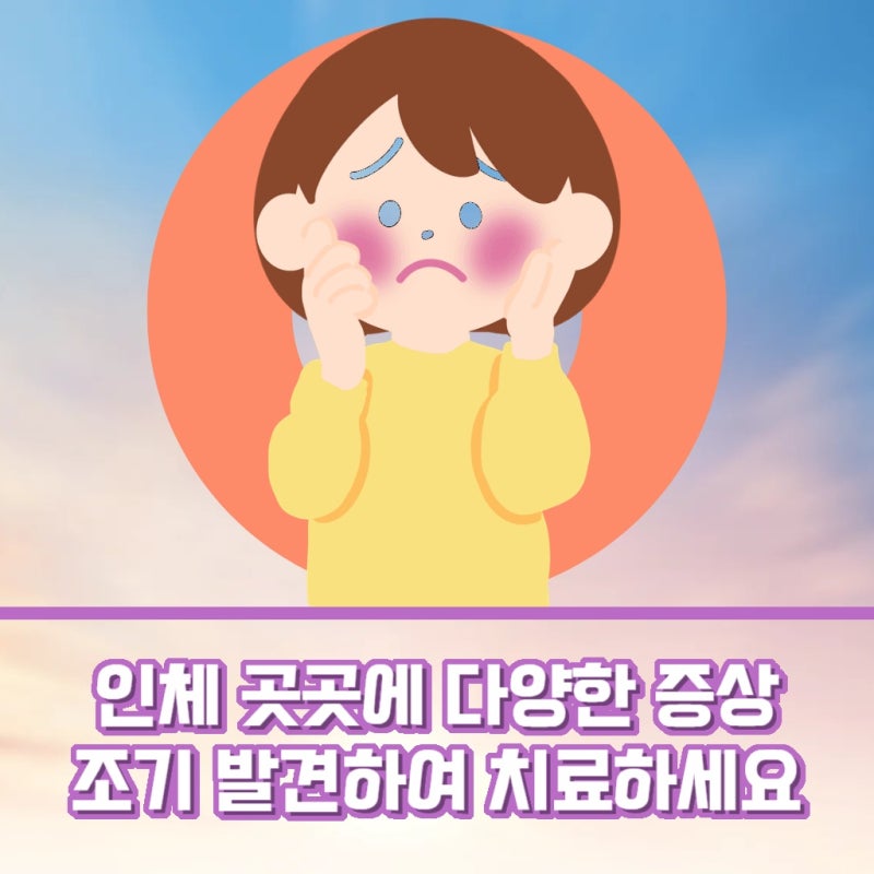 이유 없는 관절 통증과 피부 이상 혹시 루푸스 병?