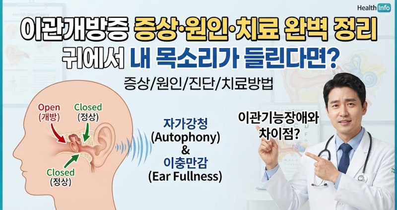 이관개방증 증상과 원인 치료방법 총정리｜이관기능장애와 차이, 귀에서 내 목소리가 들리....