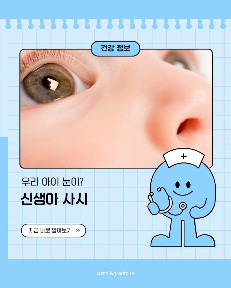 신생아 아기 사시 증상 원인 유아사시 알아봐요