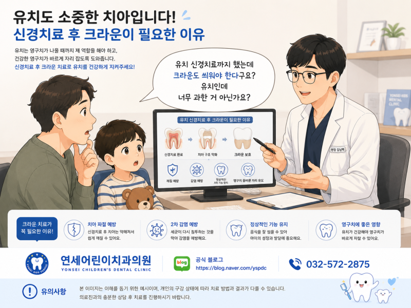 인천서구 어린이치과 유치 크라운치료, 신경치료 후 꼭 씌워야 하나요?