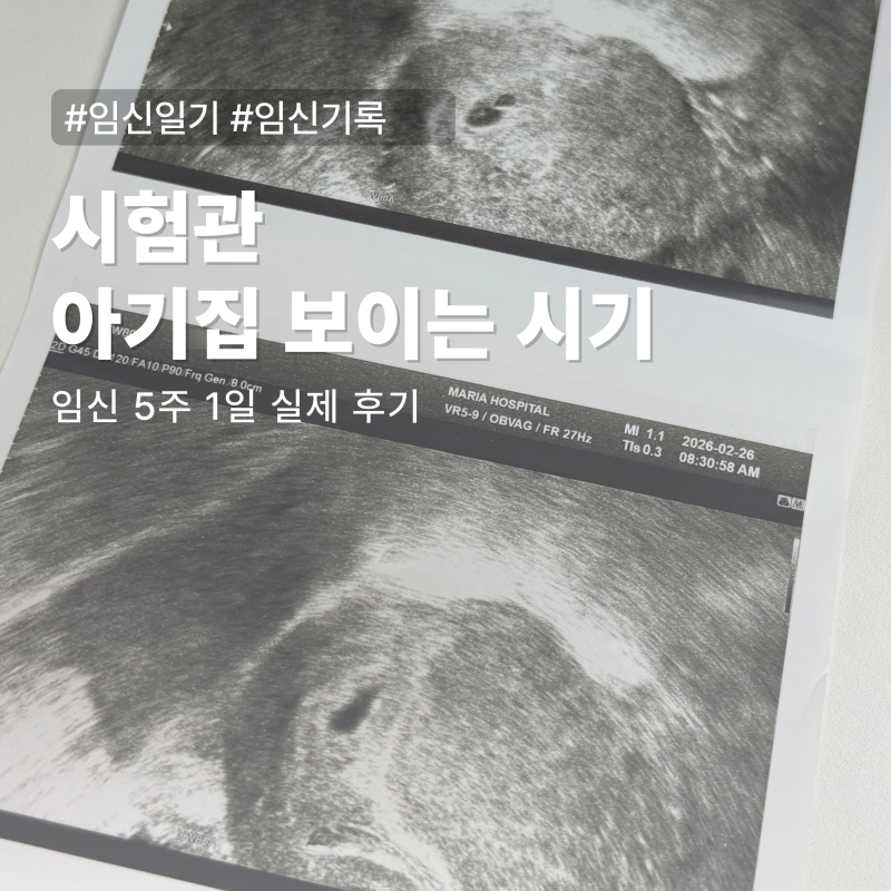 시험관 아기집 보이는 시기 임테기 역전 후 2차 피검사