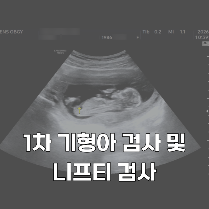 12주차 1차 기형아 검사 & 니프티(NIPT) 검사 후기 | 퀸스산부인과 다녀왔어요 (떨렸던 목투명....