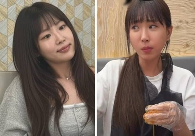 "이게 제 원래 얼굴입니다" 강예원 얼굴이 또 바뀐 진짜 이유…7번의 수술이 남긴 것