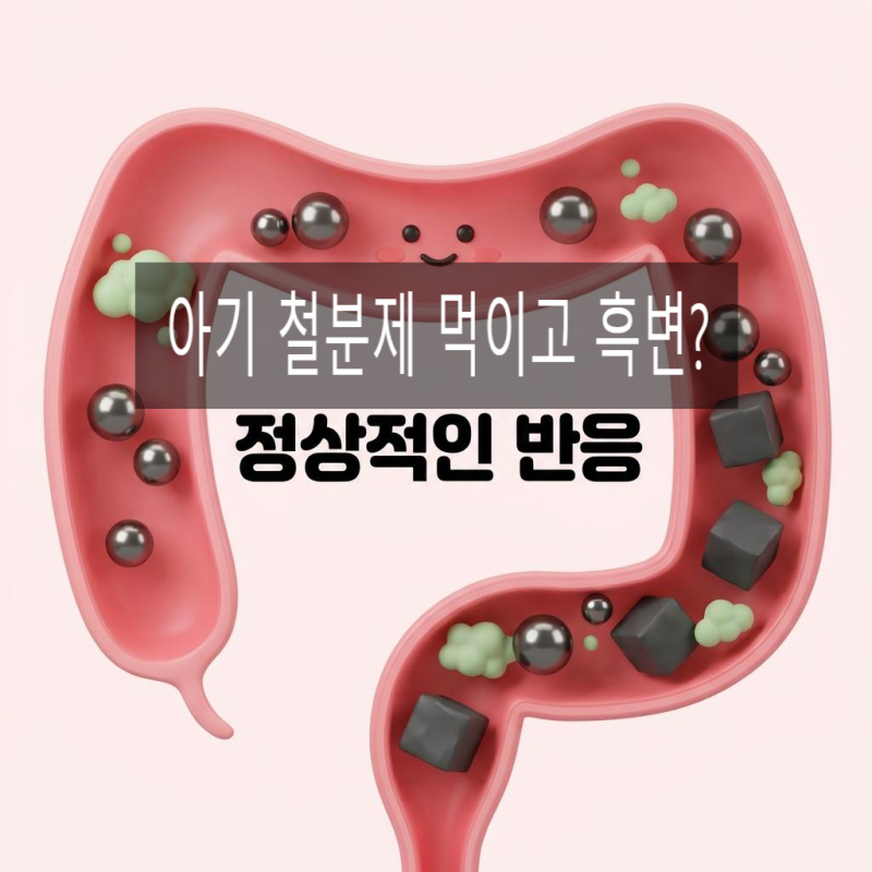아기 액상 철분제 먹고 '검은 똥'·'치아 변색'? 응급실 가기 전 꼭 알아야 할 주의사항