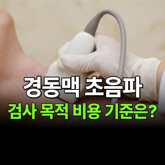 경동맥 초음파로 알 수 있는 것은? 경화반 결과 해석부터 검사 비용까지