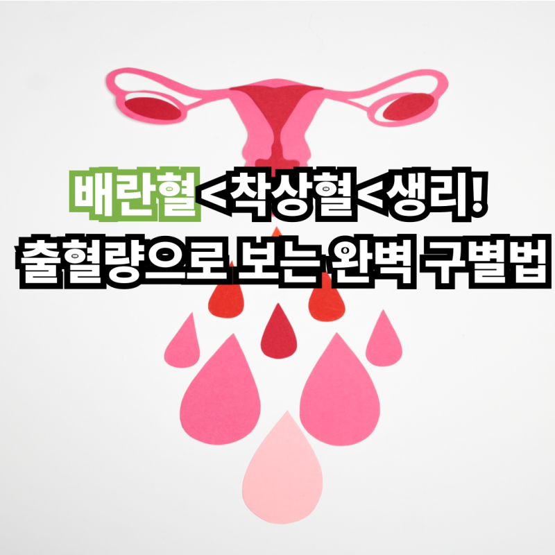 배란혈<착상혈<생리! 출혈량으로 보는 완벽 구별법