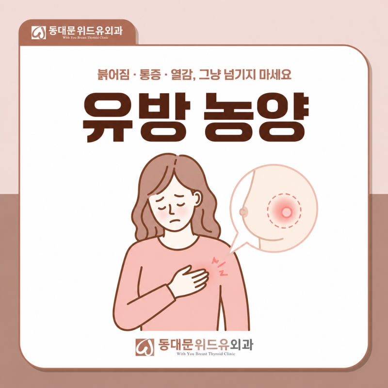 "가슴이 부풀고 아픈 이유" 유방 농양이란?