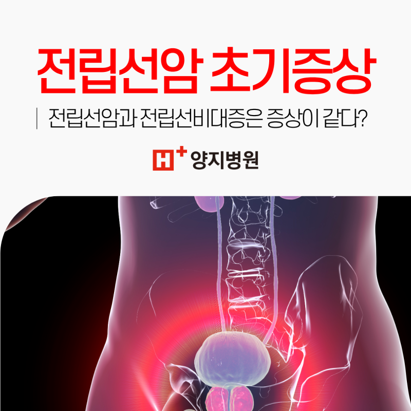 전립선암 초기증상, 전립선비대증과 거의 같아 자가진단은 위험합니다