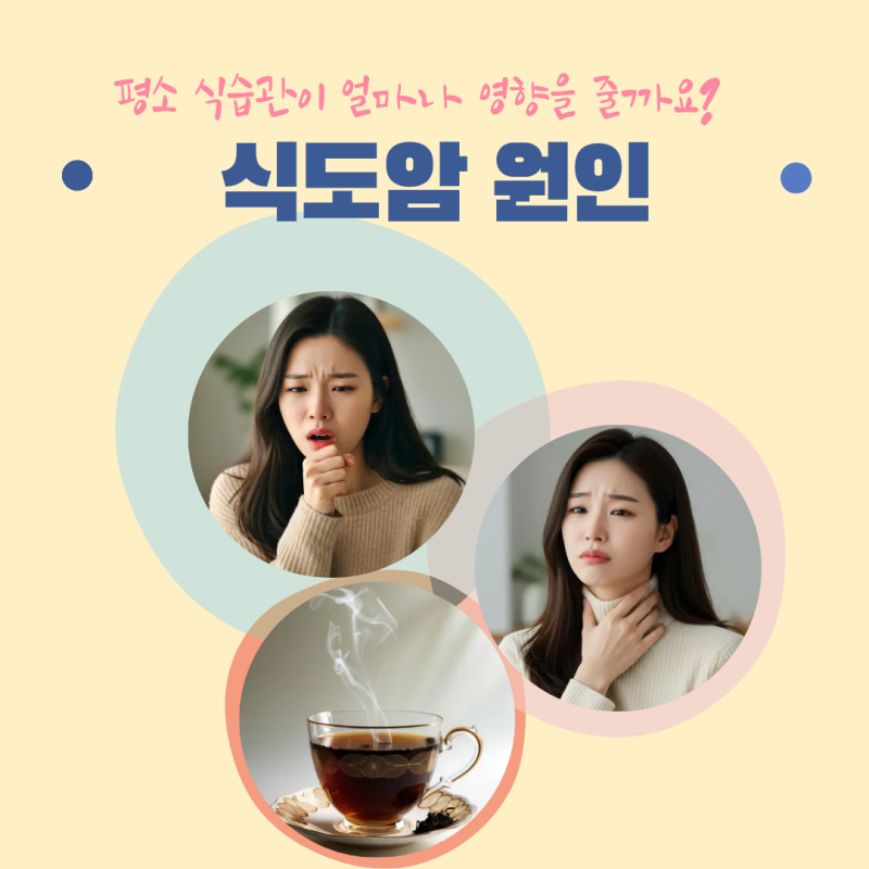 식도암원인 무엇일까? 초기증상과 함께 꼭 알아야 할 위험요인