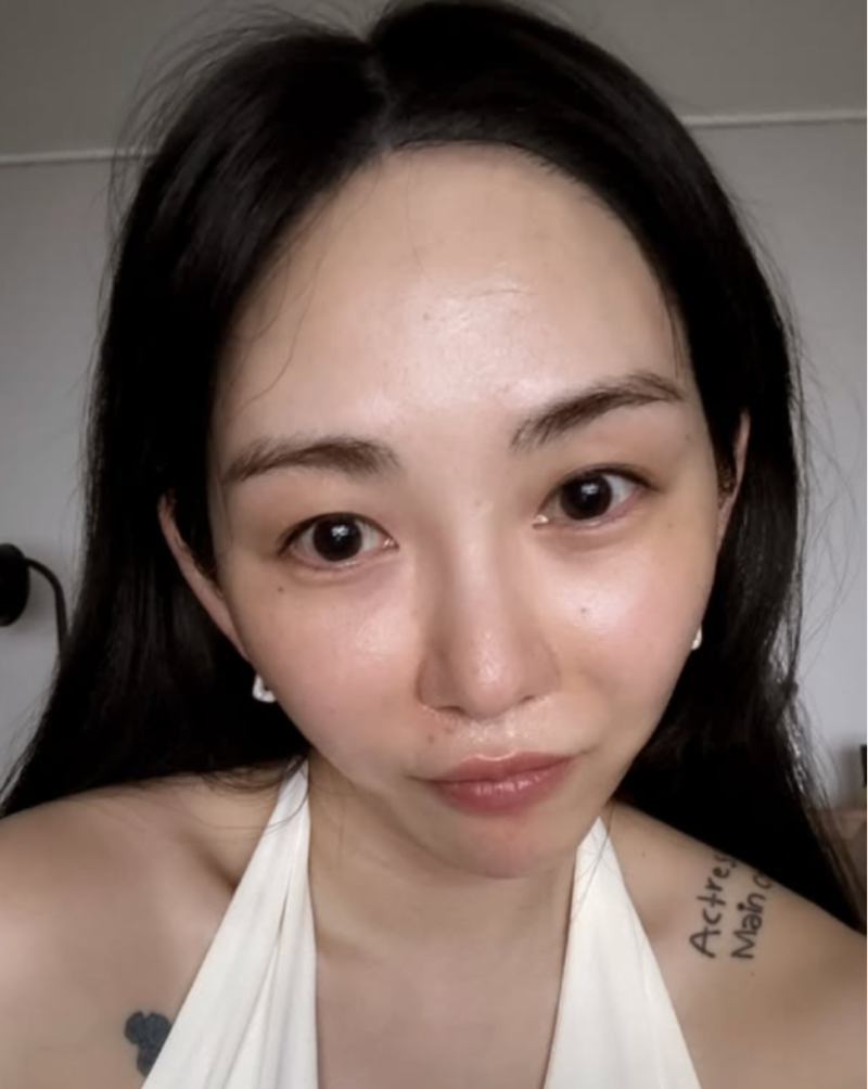 권민아 화상 흉터 회복 근황, 화장 지운 셀카에서 옅어진 양 볼 상처