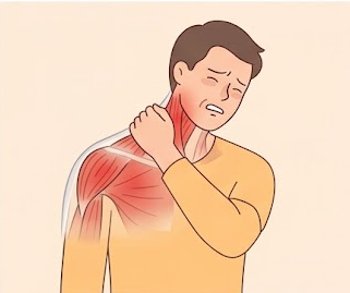 근막동통증후군이란? 원인, 증상, 스트레칭, 치료법 알아보기