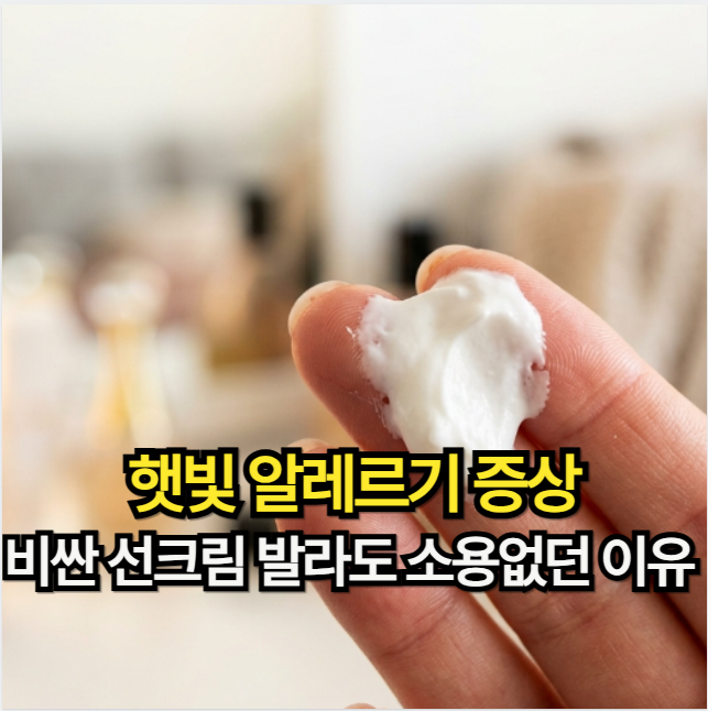 햇빛 알레르기 증상! 비싼 선크림 발라도 소용없던 이유 (자외선 차단제 바르는 법)
