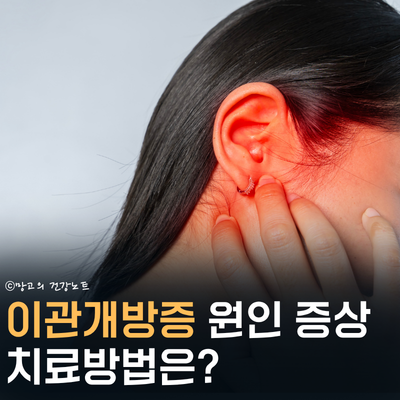 귀 먹먹함? 이관개방증 증상 원인 및 치료 관리법