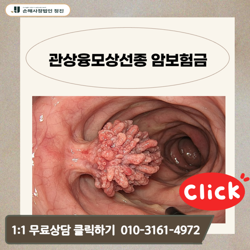 관상융모상선종 암보험금, D12.6 코드 받아도 제자리암 지급 가능할까?