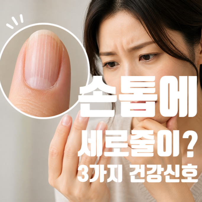 손톱에 세로줄이 생겼다면? 노화보다 먼저 확인해야 할 건강 신호 3가지