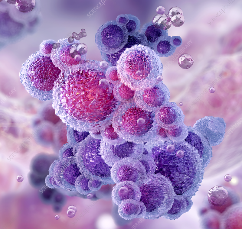 사상 산부인과 유레아플라즈마 유레알리티쿰(Ureaplasma urealyticum)의 증상 진단 치료 등에 관하....