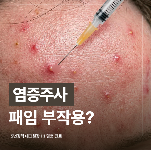 삼성역 염증주사, 여드름 염증주사 부작용 패임 예방하려면?