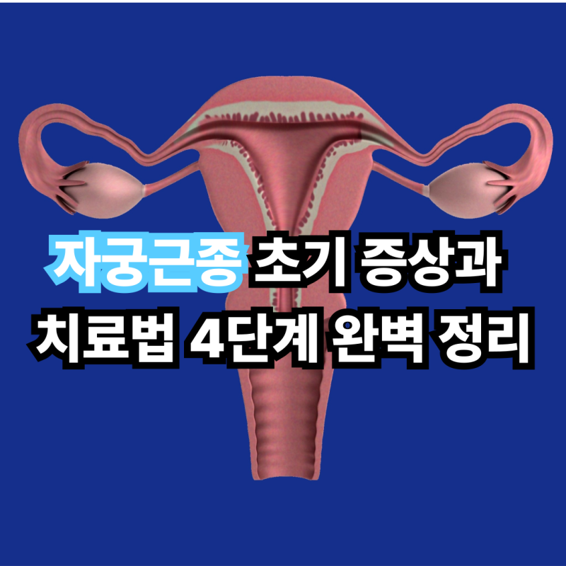 자궁근종 초기 증상과 치료법 4단계 완벽 정리