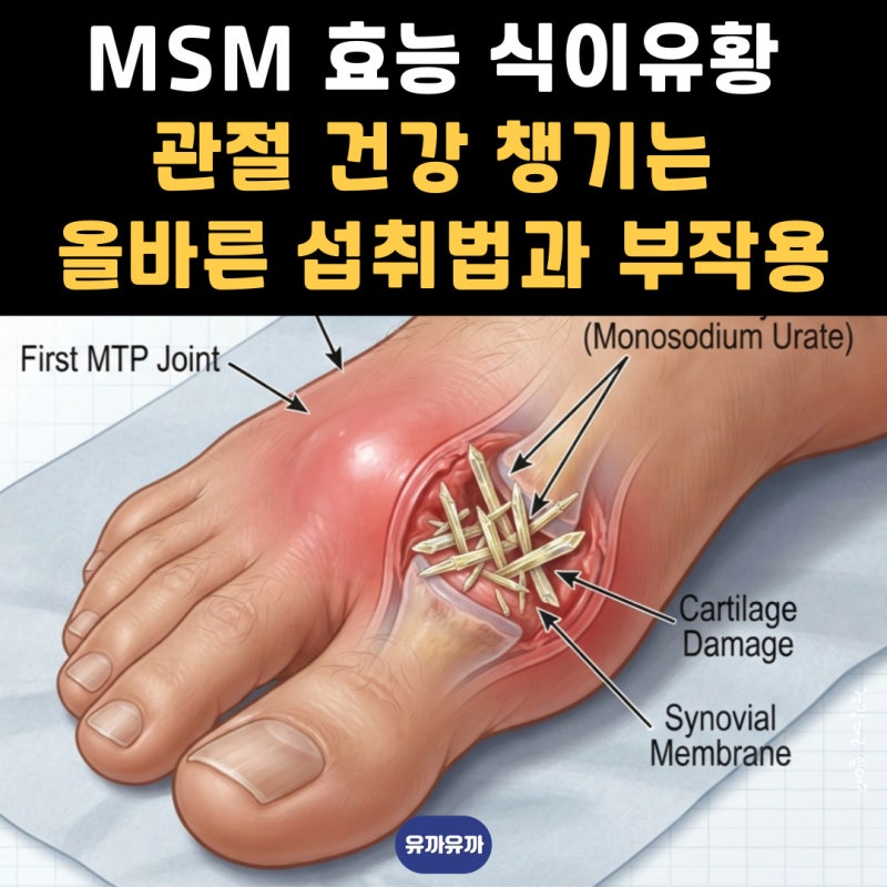 MSM 효능 식이유황 관절 건강 챙기는 올바른 섭취법과 부작용