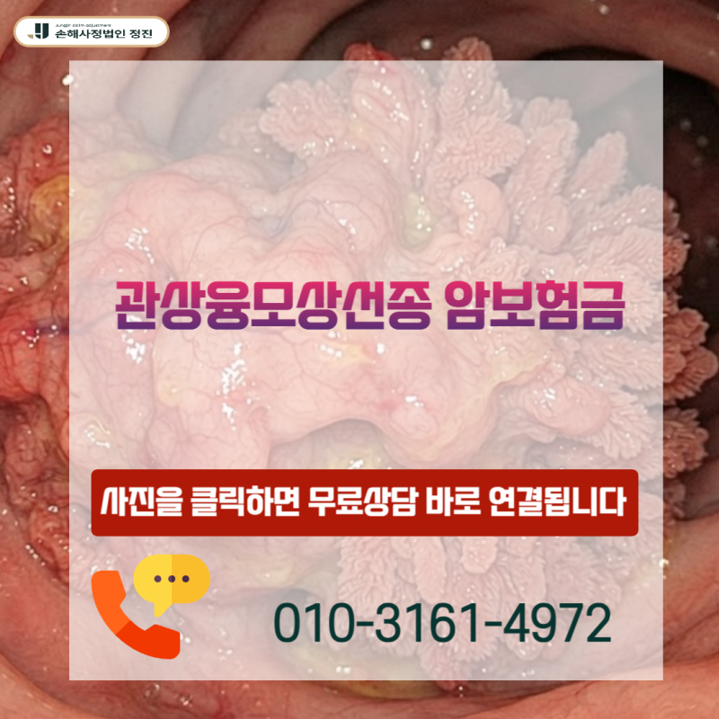관상융모상선종 암보험금, D12.6 양성 신생물 진단 후 제자리암 보상받는 방법은 무엇일까요?