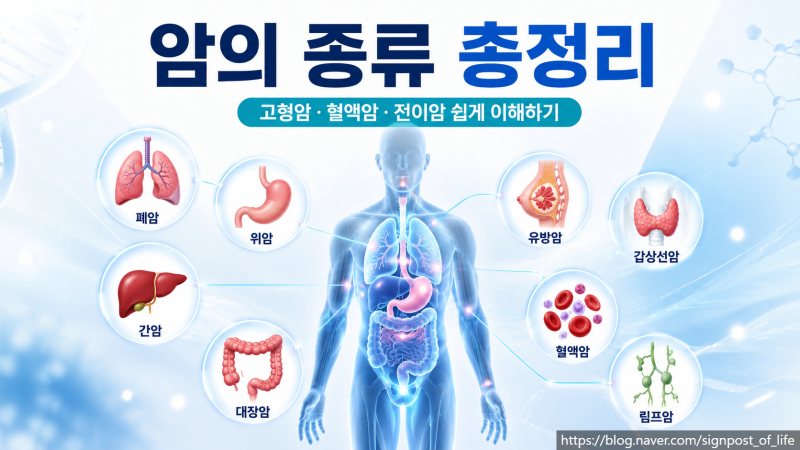 암 완전정복 시리즈 ②암의 종류 총정리｜고형암·혈액암·전이암 차이 쉽게 이해하기