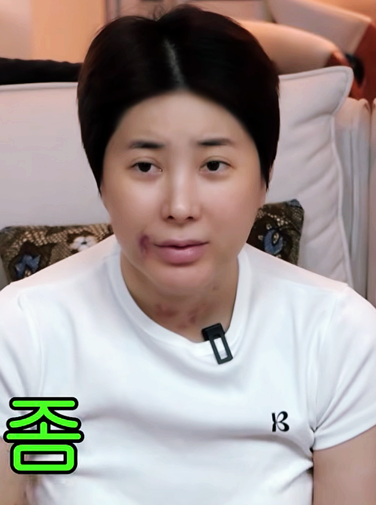 개과천선 <b>서인영</b> 워터밤 출연료 싹 다 털어 팔 <b>지방흡입</b>에 얼굴... 